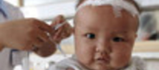 EPIDEMIA DI COLERA NASCOSTA PER 12 GIORNI