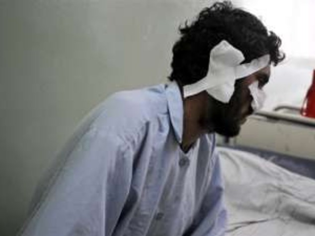 AFGHANISTAN: SFIDA TALEBANI E VOTA, MUTILATO DI NASO E ORECCHIE