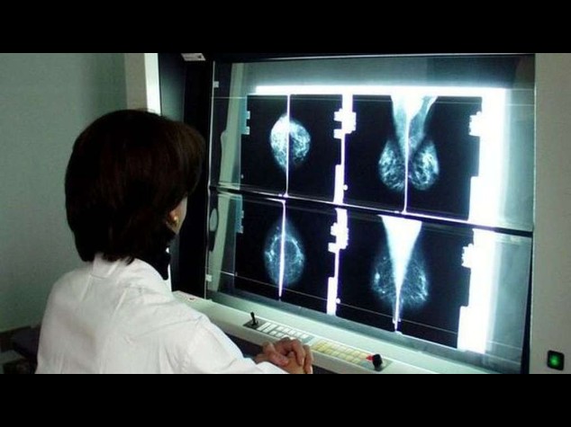 Scoperto il legame tra colesterolo alto e cancro seno