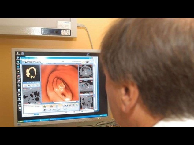Classificazione carcinoma colon-retto migliora terapie