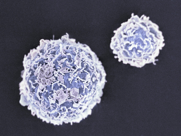 Staminali, tracciate cellule dopo trapianto