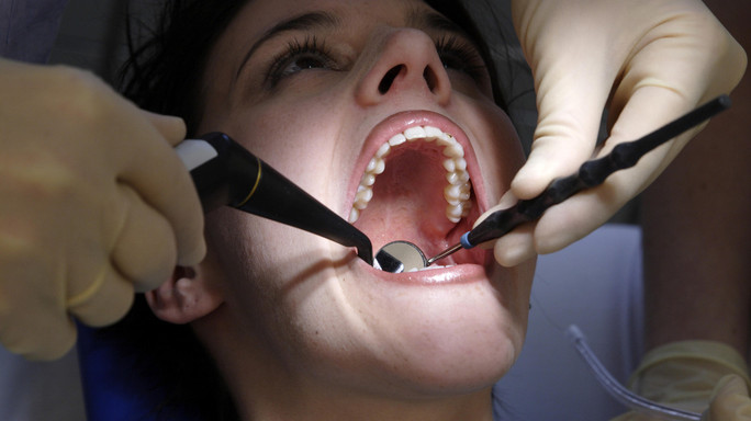 Anche i dentisti sentono il morso
