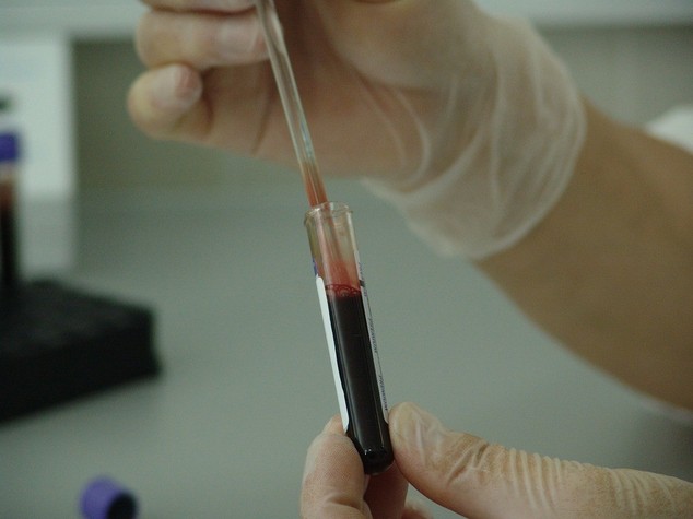 Tumori: esperto, servono investimenti per immunoterapia in Italia