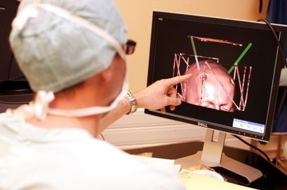 Un vademecum per proteggere il cervello in vacanza
