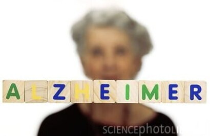 Rischio Alzheimer, un test prevede le tempistiche della comparsa dei sintomi