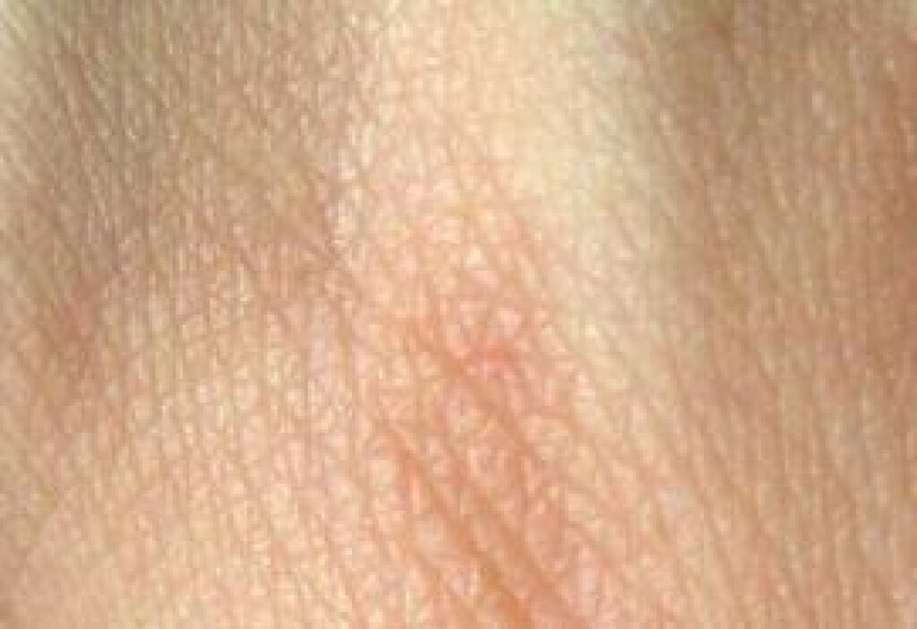 Scoperto il gene da cui dipende il colore della pelle e dei capelli