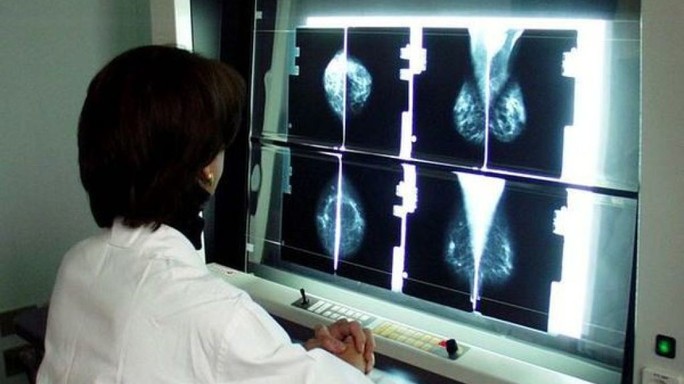 Tumori: esperti, ogni giorno 30 nuove diagnosi in under 40