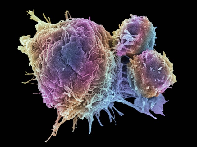 Tumori: scoperta proteina che previene mutazioni cancerose