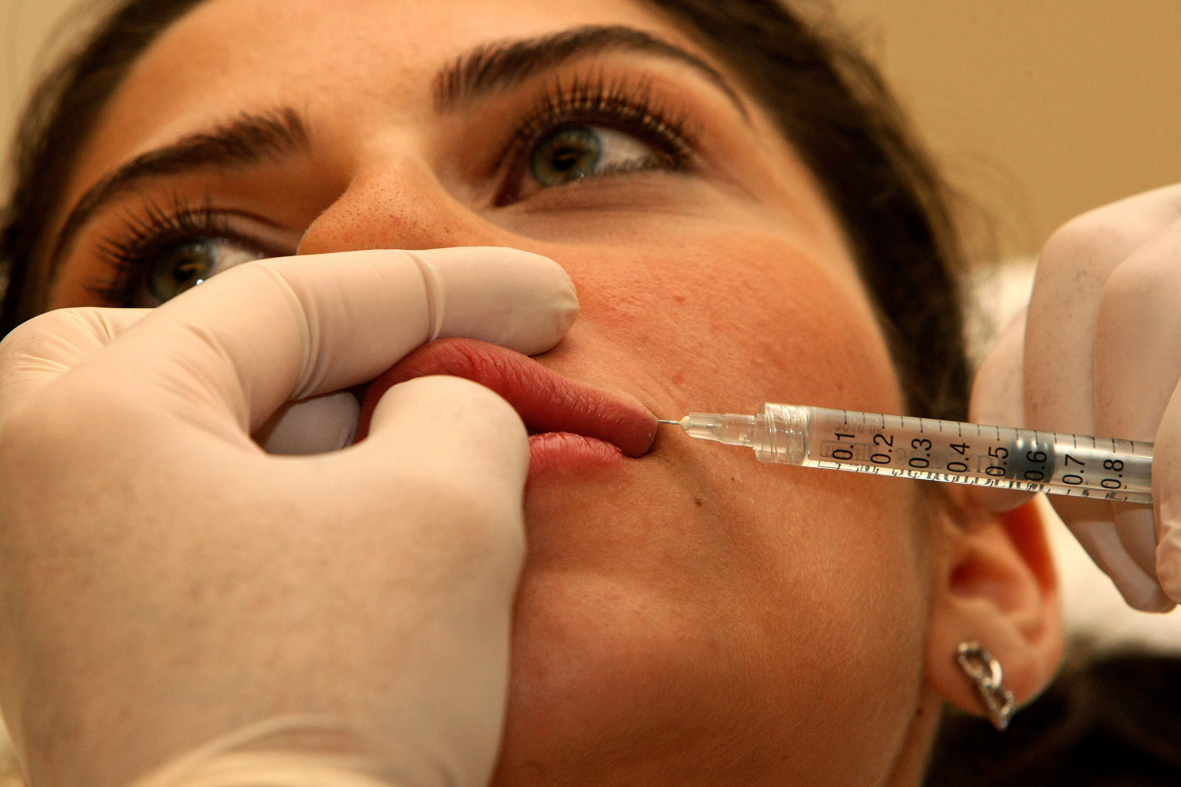 Filler e Botulino: il boom dei "ritocchini" e i rischi nascosti