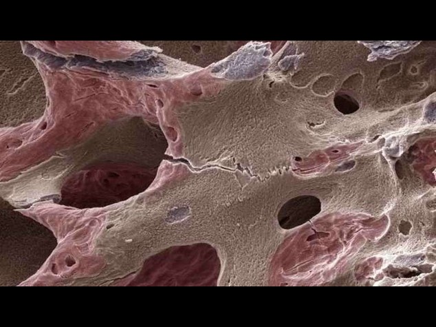 Osteoporosi: da proteina denti un aiuto per rigenerazione ossea