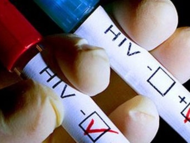 Allarme Aids tra gli adolescenti, dal 2000 raddoppiato numero dei morti