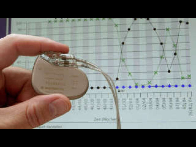 Cuore: creati 'pacemaker biologici' efficaci e sicuri