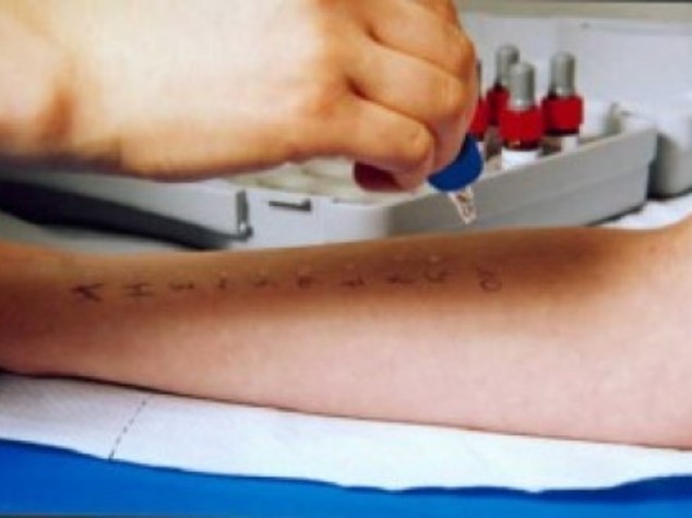 Allergi: boom di test ma 1 italiano su 4 e' "malato immaginario"