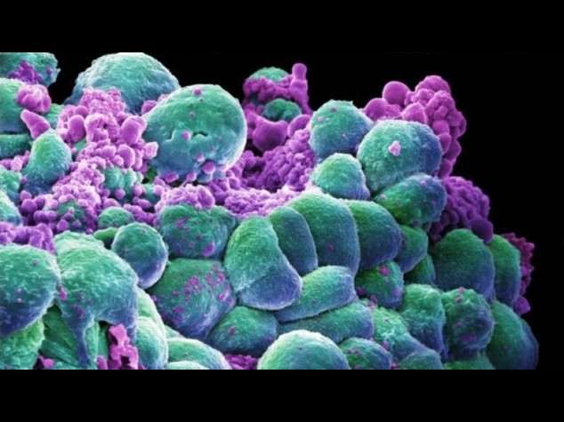 Aids: per la prima volta eliminato Hiv da cellule umane coltivate