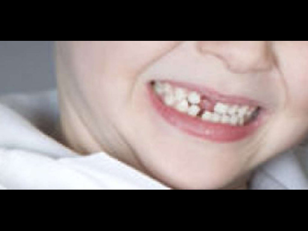 Estate: dentisti, ecco decalogo per proteggere sorriso bimbi