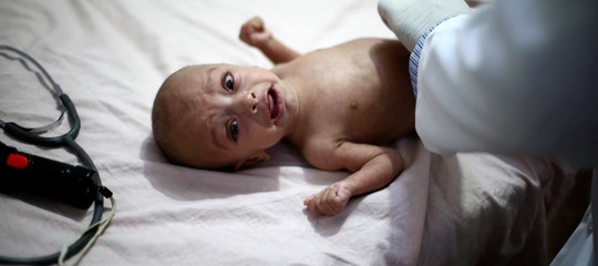 Morire di fame dopo un mese di vita, in Siria