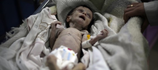 Morire di fame dopo un mese di vita, in Siria