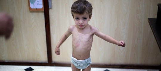 Morire di fame dopo un mese di vita, in Siria