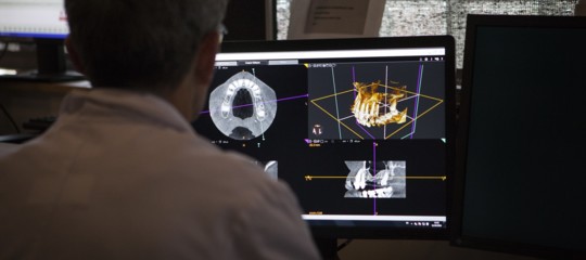 Una stampante 3d restituisce un volto a chi non lo ha più