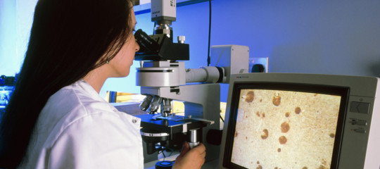 pfizer ricerca farmaci alzheimer