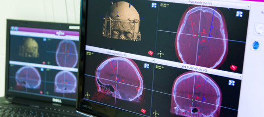 Un italiano ha inventato uno strumento per la diagnosi precoce del Parkinson