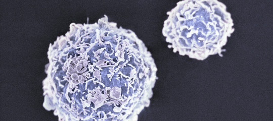 La terapia genica per la talassemia è promettente. Ma bando ai facili entusiasmi