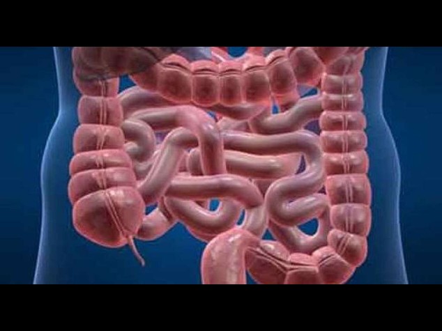 Batteri intestinali trasformano carboidrati in cancro colon-retto