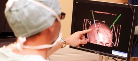 Cosa succede esattamente nel cervello di una persona dotata di super memoria