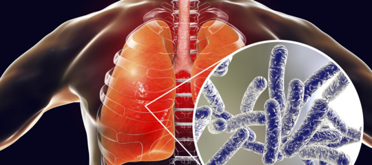 Legionella: terza vittima nel Milanese