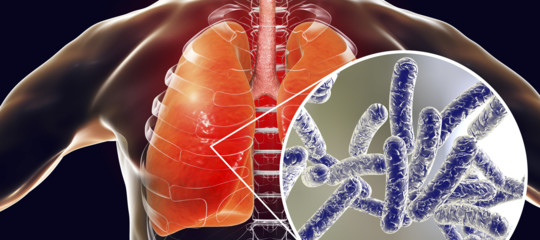 Legionella, sale a 26 il bilancio delle persone contagiate