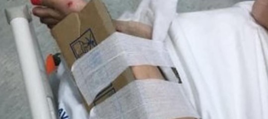 Ingessature col cartone a Reggio Calabria: due indagini per capire com'è andata