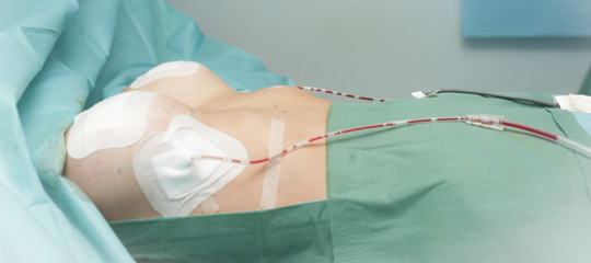 C'è uno scandalo internazionale che riguarda protesi sanitarie malfunzionanti