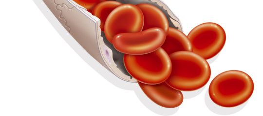 Dopo il sangue, ecco i vasi sanguigni “sintetici”