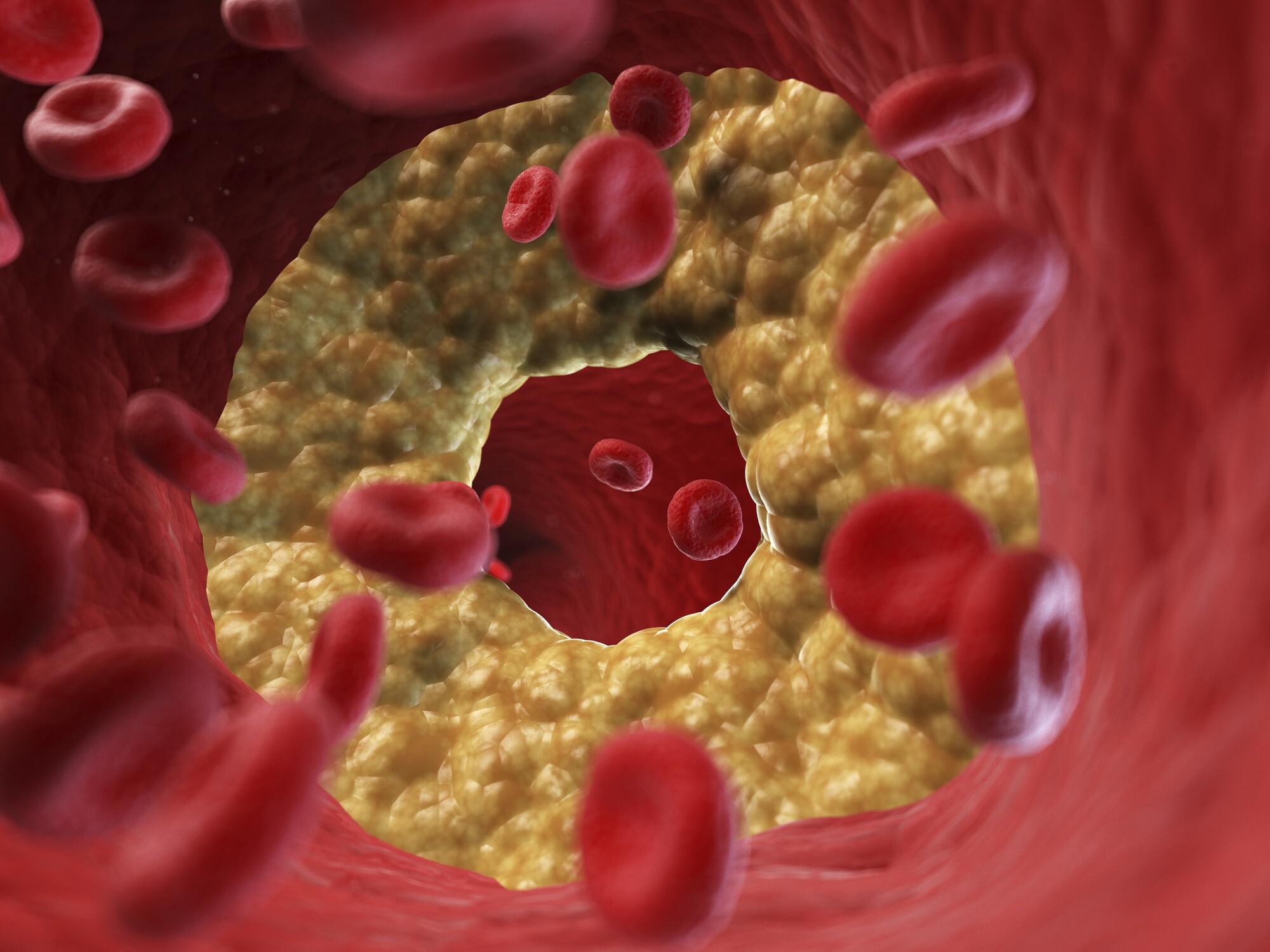Dimagrimento e salute cardiovascolare: ogni kg perso migliora trigliceridi e colesterolo