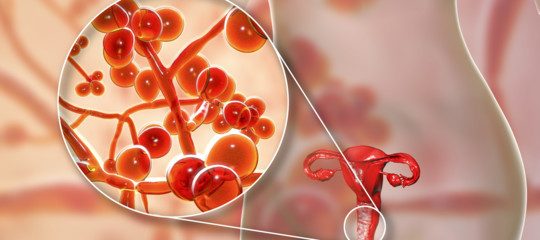 fungo killer candida auris