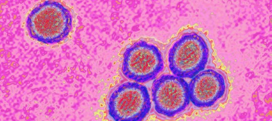 virus west nile