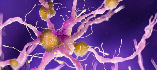 Alzheimer scoperta test sangue