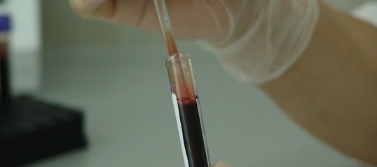 test sangue prevede quando si muore