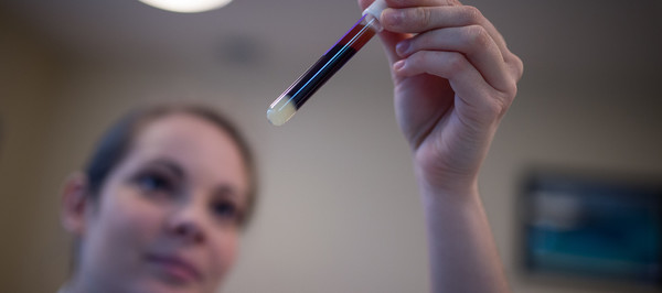 no controindicazioni donazione sangue vaccinati