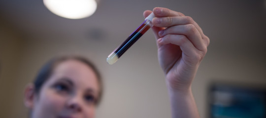 frequenza donazioni sangue