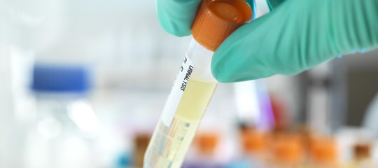 water intelligente analisi diagnosi precoci