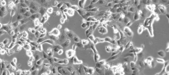 Spallanzani isolato coronavirus