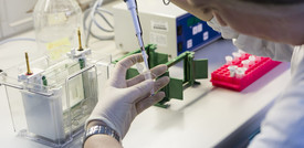 Speranze da un vecchio farmaco antimalarico: "In laboratorio funziona contro il virus"