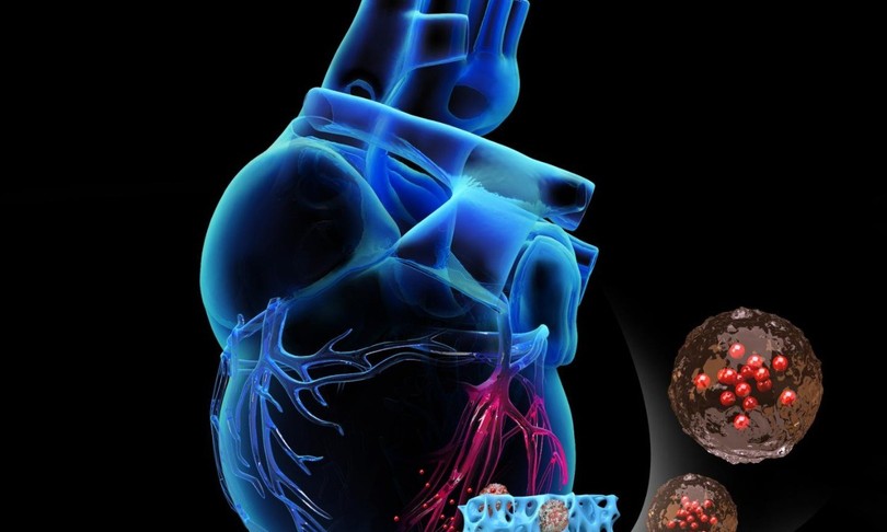 salute cerotto cardiaco infarto