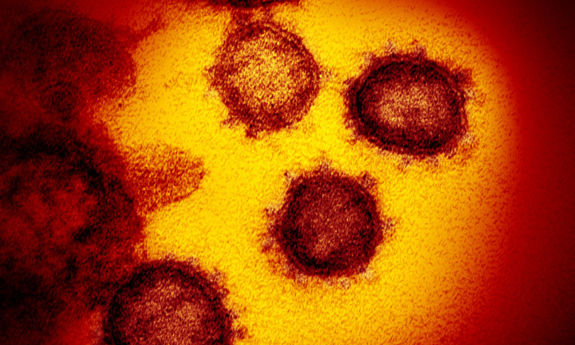 Usa Cina Wuhan coronavirus laboratorio