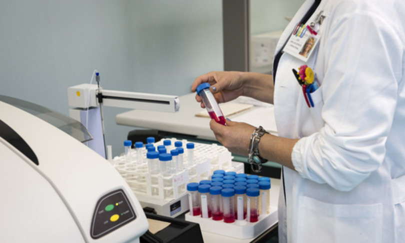 coronavirus test esperti