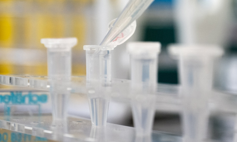 coronavirus covid 19 croce rossa italia test sierologici