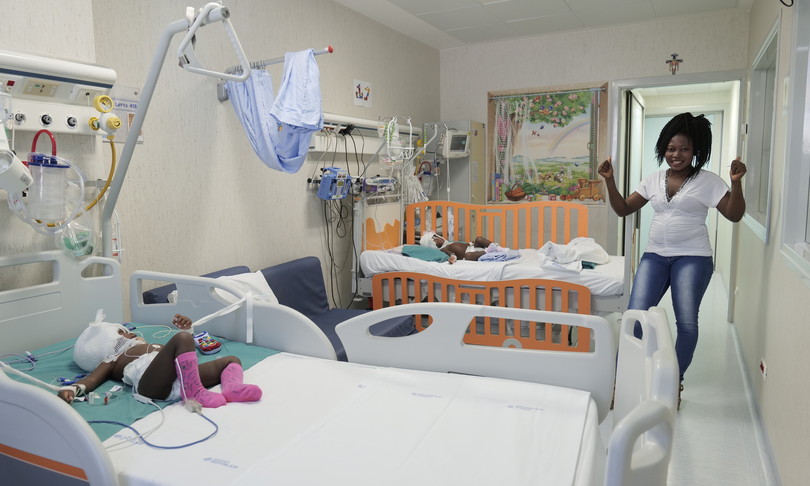 separate gemelle siamesi unite alla testa bambino gesu