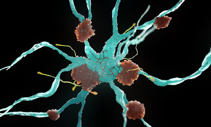 individuato gene contrasta morbo alzheimer