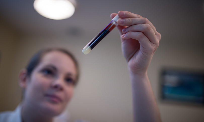 Coronavirus analisi sangue gravità infezione